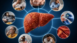 Fatty Liver Risk Factors: किन लोगों को होता है फैटी लिवर का अधिक खतरा? कैसे जानें कि आपका लिवर फैटी है, एक्सपर्ट ने बताएं लक्षण और बचाव