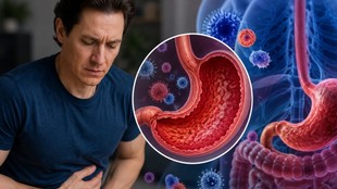 Autoimmune gastritis,Bryan  Johnson,Bryan Johnson Autoimmune Gastritis,Autoimmune Gastritis signs,Autoimmune Gastritis symptoms,Autoimmune Gastritis signs and symptoms,signs of Autoimmune Gastritis,