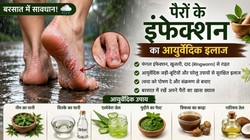 Monsoon Infection: बारिश में पैरों की खुजली और जिद्दी दाद से हैं परेशान? आयुर्वेदिक डॉक्टर के इन 7 उपायों से मिलेगा आराम