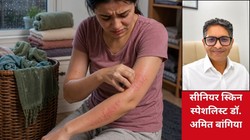 स्किन इन्फेक्शन और एलर्जी का साइलेंट अड्डा हैं घर में रखी ये 5 चीजें! मानसून में बचाव के लिए डर्मेटोलॉजिस्ट के इन टिप्स को न करें इग्नोर