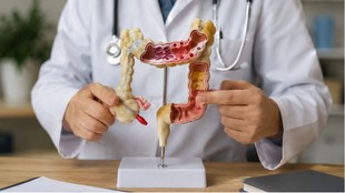 colon cancer symptoms, signs of colon cancer, colon cancer warning signs, changes in stool cancer, blood in stool reasons, bowel movement changes, early signs of colon cancer,
