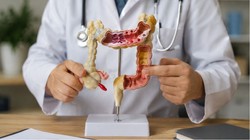 मल में दिखने वाले ये 5 बदलाव हो सकते हैं Colon Cancer के संकेत; कैंसर के डॉक्टर से जानिए शुरुआती लक्षण और पहचान का तरीका