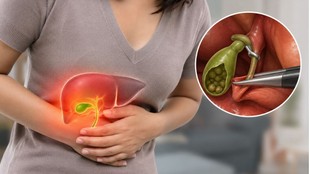 gallbladder removal fatty liver link, cholecystectomy side effects digestion, MASLD metabolic steatotic liver disease, Dr Sudeep Khanna Apollo Hospital, gut liver axis bile acids