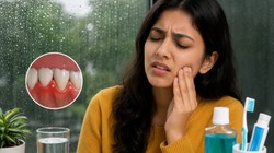 Monsoon Oral Health: मानसून में क्यों आने लगती है मुंह से बदबू और मसूड़ों से खून? डेंटिस्ट से जानिए वजह और बचाव