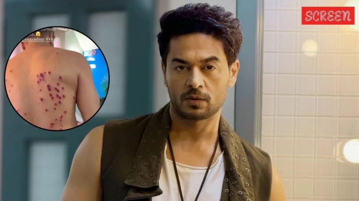 Khatron Ke Khiladi 15: रबर बुलेट वाले स्टंट के दौरान घायल हुए गौरव खन्ना और शगुन शर्मा, शरीर पर पड़े गहरे निशान