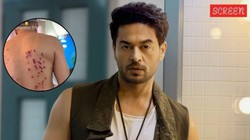 Khatron Ke Khiladi 15: रबर बुलेट वाले स्टंट के दौरान घायल हुए गौरव खन्ना और शगुन शर्मा, शरीर पर पड़े गहरे निशान