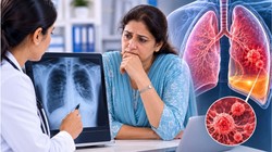 Lung Cancer Signs: फेफड़ों के कैंसर के शुरुआती लक्षण क्या हैं? जानें कब अस्थमा जैसे संकेत हो सकते हैं गंभीर- एक्सपर्ट्स की राय
