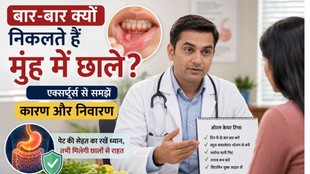 best home remedies of mouth ulcer, mouth ulcer cause, home remedies of ulcer,Best Natural and Home Remedies for Ulcers,How can I heal mouth ulcer,मुंह में अल्सर का कारण,