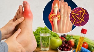 uric acid, uric acid foods to avoid, uric acid treatment, uric acid symptoms, high uric acid, reduce uric acid, how to lower uric acid, how to reduce uric acid, uric acid foods