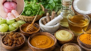 muh ke chale kaise thik kare, muh ke chale, muh ke chale kaise thik kare, muh ke chale thik kare, muh ke chale ka ilaj, muh ke chale kyu hote hai, Why does a mouth ulcer happen, What is the best treatment for mouth sores,