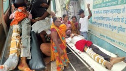 बाइक एक्सीडेंट में टूटे पैर तो सरकारी अस्पताल ने लपेट दिए ‘गत्ते’, तेजस्वी यादव बोले- विभाग ही ICU में है