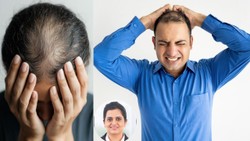 हेयर लॉस का दर्द सिर्फ आईने तक सीमित नहीं, मानसिक सेहत पर भी पड़ता है गहरा असर