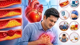 Heart Attack Causes, Heart Attack Risk Factors, Heart Disease, High Cholesterol, High Triglycerides, High Blood Pressure, Diabetes and Heart Disease, Obesity and Heart Health, Stress and Heart Health