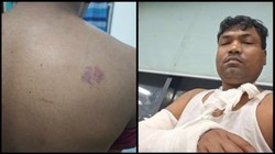 ‘लाठियों से पीटा, लातें मारीं’, CJP प्रदर्शन में हिरासत में लिए गए लोगों का आरोप- पुलिस ने की मारपीट, मेडिकल रिपोर्ट में चोटों का जिक्र