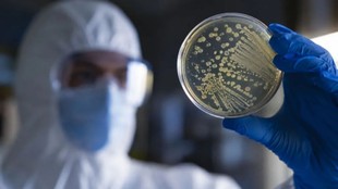 Russia pneumonic plague death Irkutsk lab, pneumonic plague symptoms transmission incubation period, Yersinia pestis pneumonic vs bubonic plague, Dr Jatin Ahuja Apollo pneumonic plague