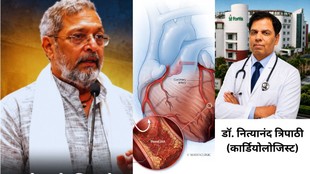 cardiac arrest, nana patekar cardiac arrest 75 heart, nana patekar death heart arrest doctor, Nana Patekar death,